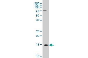 TTC11 polyclonal antibody (A01), Lot # 051206JC01 Western Blot analysis of FIS1 expression in MES-SA/Dx5 .
