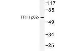 Western blot analysis of TFIIH p62 antibody in extracts from Jurkat cells.