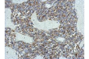 IHC-P Image Immunohistochemical analysis of paraffin-embedded BT483 xenograft, using KCNG4, antibody at 1:500 dilution.