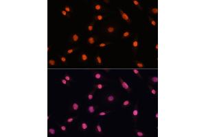 Immunofluorescence analysis of L929 cells using CHD4 antibody (ABIN6127308, ABIN6138512, ABIN6138513 and ABIN6215263) at dilution of 1:100.