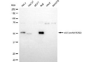 Western blotting analysis using p53 (acetyl K382) antibody (ABIN7800683). (Recombinant p53 anticorps  (acLys382))