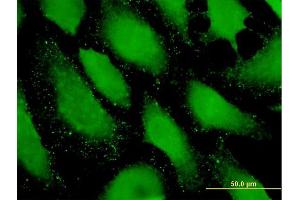 Immunofluorescence of purified MaxPab antibody to PDZRN4 on HeLa cell. (PDZRN4 anticorps  (AA 1-778))