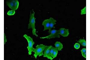 Immunofluorescent analysis of MCF-7 cells using ABIN7170011 at dilution of 1:100 and Alexa Fluor 488-congugated AffiniPure Goat Anti-Rabbit IgG(H+L)