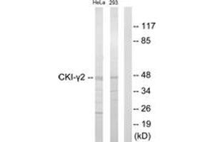 Western blot analysis of extracts from HeLa/293 cells, using CKI-gamma2 Antibody. (Casein Kinase 1 gamma 2 anticorps  (AA 10-59))