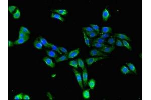 Immunofluorescent analysis of HepG2 cells using ABIN7172082 at dilution of 1:100 and Alexa Fluor 488-congugated AffiniPure Goat Anti-Rabbit IgG(H+L) (CDKAL1 anticorps  (AA 1-97))