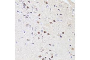 Immunohistochemistry of paraffin-embedded rat brain using DMAP1 antibody.