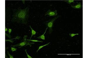 Immunofluorescence of monoclonal antibody to C4B on HeLa cell.
