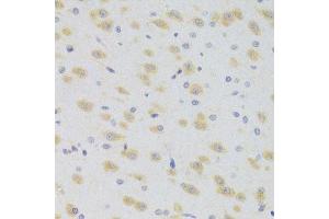 Immunohistochemistry of paraffin-embedded rat brain using SCO2 Antibody. (SCO2 anticorps  (AA 1-130))