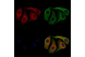ABIN7094032 and ABIN7098076 staining Hela cells by IF/ICC. (TXNDC5 anticorps  (N-Term))
