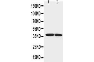 Anti-IGFBP1 antibody, Western blotting Lane 1: SMMC Cell Lysate Lane 2: MCF-7 Cell Lysate (IGFBPI anticorps  (Middle Region))