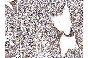 IHC-P Image EIF3K antibody detects EIF3K protein at cytosol on mouse testis by immunohistochemical analysis.