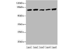 Western blot All lanes: Hspa1b antibody at 5 μg/mL Lane 1: A431 whole cell lysate Lane 2: A549 whole cell lysate Lane 3: Jurkat whole cell lysate Lane 4: MCF-7 whole cell lysate Lane 5: K562 whole cell lysate Secondary Goat polyclonal to rabbit IgG at 1/10000 dilution Predicted band size: 71 kDa Observed band size: 71 kDa (HSPA1B anticorps  (AA 2-642))