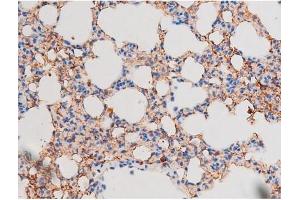 ABIN6267508 at 1/200 staining Mouse lung tissue sections by IHC-P.