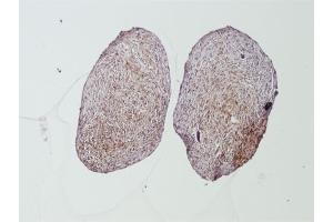 Image provided One World Lab: Paraffin embedded human cartilage labeled with Rabbit Anti-Collagen II Polyclonal Antibody (ABIN672171) at 1:100 overnight 4 °C followed by conjugation to secondary antibody.
