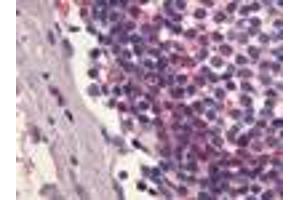 Anti-S1PR4 / EDG6 antibody IHC of human lymph node. (S1PR4 anticorps  (C-Term))