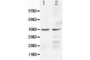 Anti-CCR5 antibody, Western blotting Lane 1: JURKAT Cell Lysate Lane 2: COLO320 Cell Lysate (CCR5 anticorps  (N-Term))