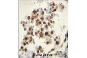 CYP5A1 Antibody (Center) (ABIN656016 and ABIN2845391) immunohistochemistry analysis in formalin fixed and paraffin embedded human lung tissue followed by peroxidase conjugation of the secondary antibody and DAB staining.