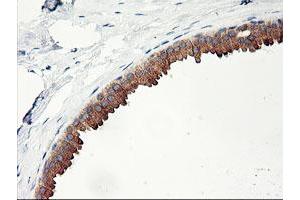 Immunohistochemical staining of paraffin-embedded Human breast tissue using anti-PHF21B mouse monoclonal antibody. (PHF21B anticorps)
