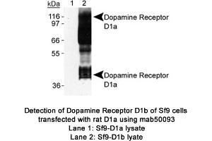 Image no. 1 for anti-Dopamine Receptor D1 (DRD1) (C-Term) antibody (ABIN363247) (Dopamine Receptor d1 anticorps  (C-Term))