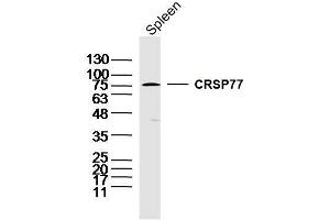 Mouse spleen lysates probed with CRSP77 Polyclonal Antibody, unconjugated  at 1:300 overnight at 4°C followed by a conjugated secondary antibody at 1:10000 for 90 minutes at 37°C.