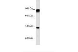 Image no. 1 for anti-Retinoblastoma Protein (Rb Protein) (AA 703-752) antibody (ABIN6735939) (Retinoblastoma Protein (Rb) anticorps  (AA 703-752))
