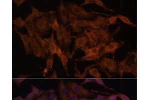 Immunofluorescence analysis of HeLa cells using TLR3 Polyclonal Antibody at dilution of 1:100. (TLR3 anticorps)
