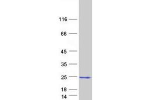 Validation with Western Blot