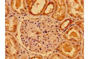Immunohistochemistry of paraffin-embedded human kidney tissue using ABIN7160238 at dilution of 1:100 (SMAD4 anticorps  (AA 27-195))