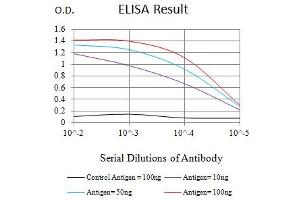 Black line: Control Antigen (100 ng),Purple line: Antigen (10 ng), Blue line: Antigen (50 ng), Red line:Antigen (100 ng)