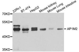 Western blot analysis of extracts of various cell lines, using AP1M2 antibody. (AP1m2 anticorps  (AA 164-423))