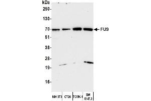 Western Blotting (WB) image for anti-Fused in Sarcoma (FUS) (AA 400-450) antibody (ABIN7453433)