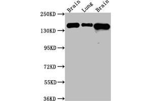 Western Blot Positive WB detected in: Rat Brain whole cell lysate, Rat Lung whole cell lysate, Mouse Brain whole cell lysate All lanes: FGFR2 Antibody at 1:1000 Secondary Goat polyclonal to rabbit IgG at 1/50000 dilution Predicted band size: 93, 87, 93, 77, 92, 89, 86, 29, 80, 93, 97, 92, 41, 80, 80, 77, 80 kDa Observed band size: 145 kDa (Recombinant FGFR2 anticorps)
