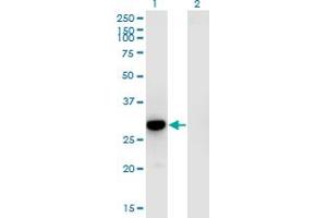 Western Blot analysis of RFXANK expression in transfected 293T cell line by RFXANK monoclonal antibody (M01), clone 4G10. (RFXANK anticorps  (AA 1-90))