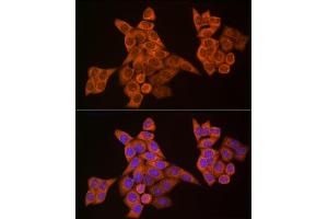 Immunofluorescence analysis of HeLa cells using Caspase-8 Rabbit pAb (ABIN6131530, ABIN6137970, ABIN6137972 and ABIN6213676) at dilution of 1:200 (40x lens).