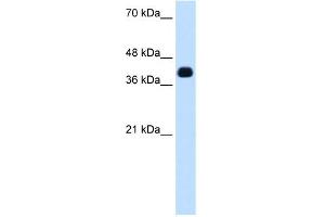 WB Suggested Anti-ZSCAN16 Antibody Titration:  0. (ZSCAN16 anticorps  (N-Term))