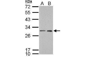 WB Image 14-3-3 sigma antibody detects SFN protein by Western blot analysis.