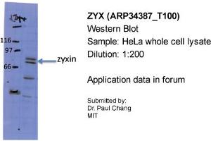 Sample Type: HeLa whole cell lysatePrimary Dilution: 1:200 (ZYX anticorps  (Middle Region))