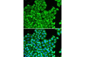 Immunofluorescence analysis of HeLa cell using CSRP1 antibody. (CSRP1 anticorps)