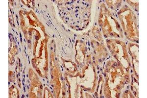 Immunohistochemistry of paraffin-embedded human kidney tissue using ABIN7153530 at dilution of 1:100 (BBOX1 anticorps  (AA 154-247))