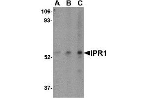 Western Blotting (WB) image for anti-SP110 Nuclear Body Protein (SP110) (C-Term) antibody (ABIN1030442) (SP110 anticorps  (C-Term))