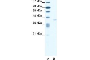 WB Suggested Anti-FOXL2 Antibody Titration: 1.