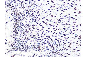Immunohistochemistry of paraffin-embedded human esophageal using DDB1 Rabbit mAb (ABIN7266673) at dilution of 1:100 (40x lens). (DDB1 anticorps)