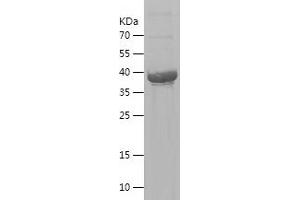 Western Blotting (WB) image for SMAD, Mothers Against DPP Homolog 3 (SMAD3) (AA 33-178) protein (His-IF2DI Tag) (ABIN7125123)