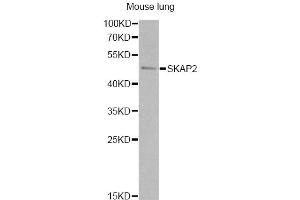 Western blot analysis of extracts of mouse lung, using SKAP2 antibody. (SKAP2 anticorps)