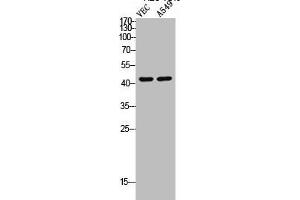 Western Blot analysis of VEC A549 cells using Cleaved-MMP-12 (G106) Polyclonal Antibody (MMP12 anticorps  (Cleaved-Gly106))