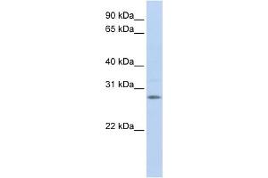 WB Suggested Anti-IGFBP4 Antibody Titration:  1 ug/ml  Positive Control:  Fetal Brain Lysate (IGFBP4 anticorps  (Middle Region))