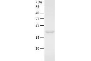 Western Blotting (WB) image for ECSIT (ECSIT) (AA 19-217) protein (His-IF2DI Tag) (ABIN7122736)