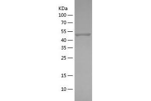 Western Blotting (WB) image for Protein Kinase, AMP-Activated, alpha 2 Catalytic Subunit (PRKAA2) (AA 340-552) protein (His-IF2DI Tag) (ABIN7124658)