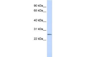WB Suggested Anti-CEACAM4 Antibody Titration:  0. (CEACAM4 anticorps  (N-Term))