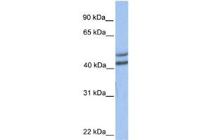 WB Suggested Anti-GALT Antibody Titration:  0. (GALT anticorps  (C-Term))